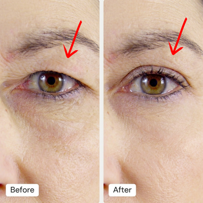 RED LIGHT EYE LIFT