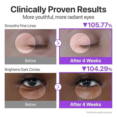Queen Eye Cream-Serum