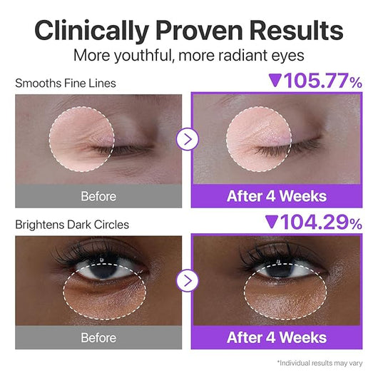 Queen Eye Cream-Serum