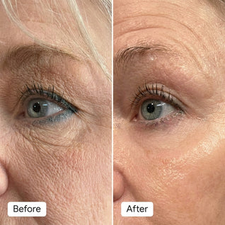 RED LIGHT EYE LIFT