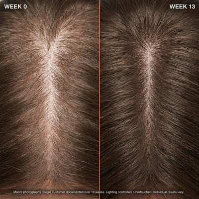 Rosemary & Rice Water Hair Spray