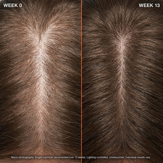 Rosemary & Rice Water Hair Spray